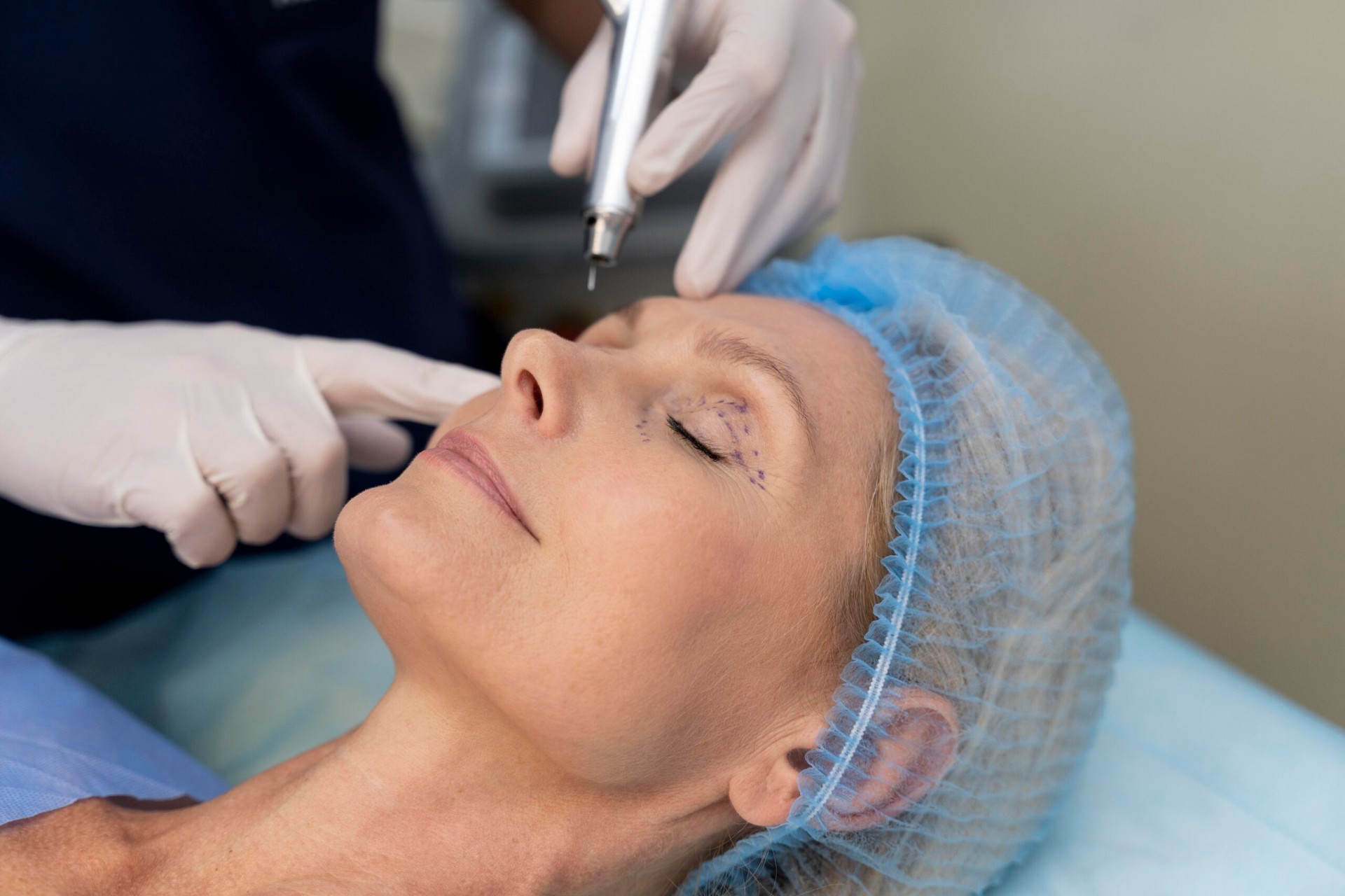 Hands-On de Blefaroplastia